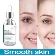 Sérum Visage aux Acides de Fruits – Anti-Imperfections